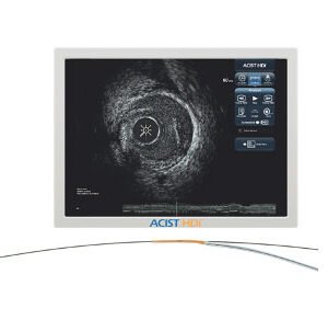 IVUS