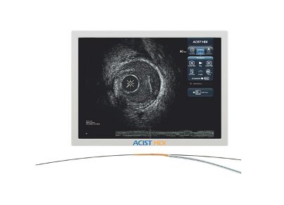 IVUS IVUS