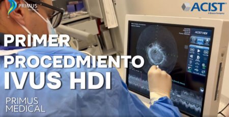 Ivus Ecuador Acist